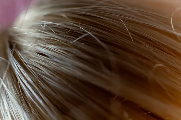 Healthy hair follicles and scalp tissue showing dense thick hair strands with visible roots, illustrating peptide benefits fo
